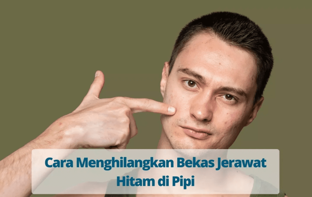Skincare untuk Jerawat